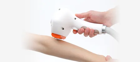 脱毛パッチテスト(無料)